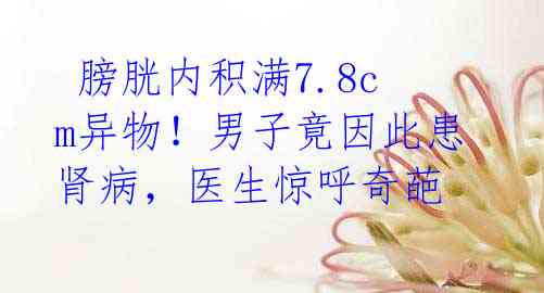 膀胱内积满7.8cm异物!男子竟因此患肾病,医生惊呼奇葩