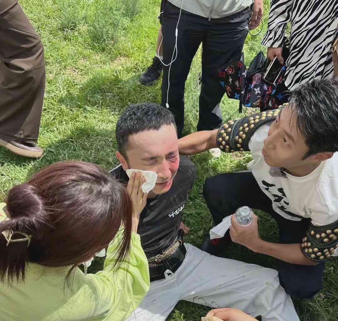  央视名主持尼格买提意外受伤 大咖撒贝宁紧张观察