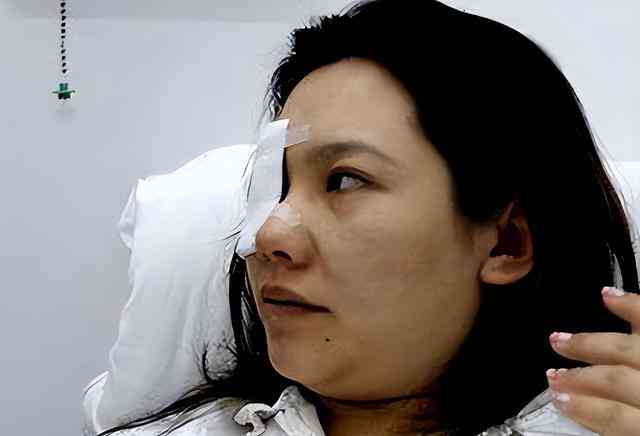  赵薇婚变危机？惊现臃肿面容和淤青的她引疑问！