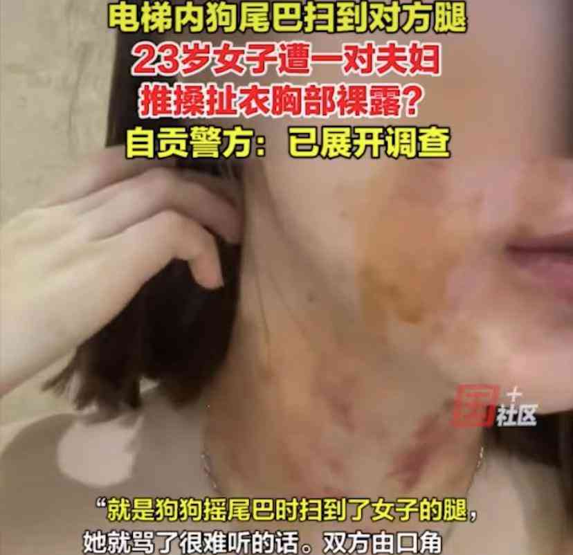  狗尾巴闹出肢体冲突，女子遭扒衣飙泪维权 