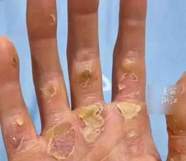00后赛艇新秀邹佳琪捧回金牌