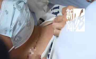 十岁儿童多次罹患甲状腺癌,专家呼吁加强防护