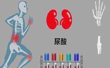 探秘高嘌呤食物中的“嘌呤大王”,预防高尿酸从饮食开始