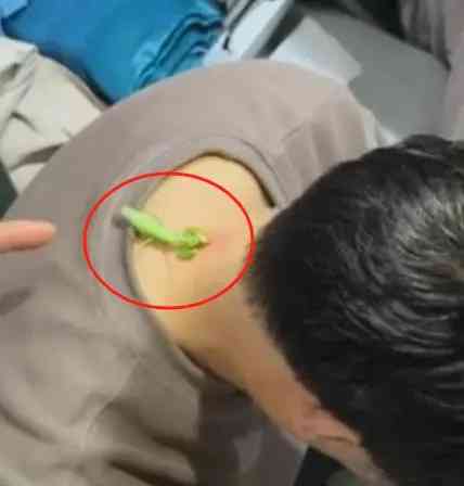 螳螂"大夫"用"独特疗法"治疗瘊子,网友吐槽...