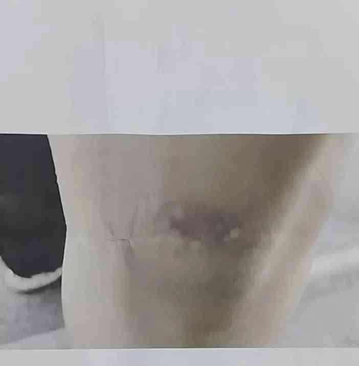 "重庆男子家属路被狗扑倒,堂堂男子堪堪避免刑责"