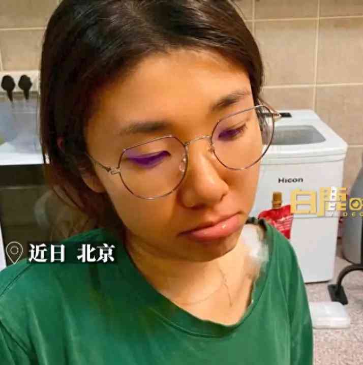  女子为减肥连吃胡萝卜3个月，脸色变成“小橘人”，惹人关注！ 