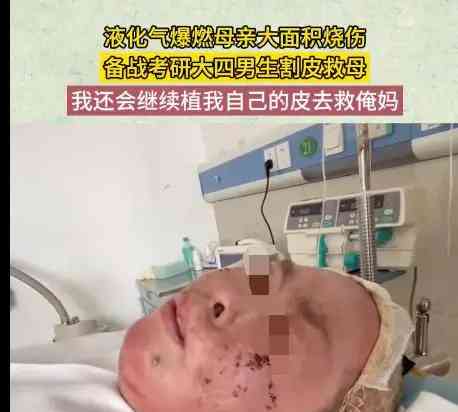 幸福不止皮肤深