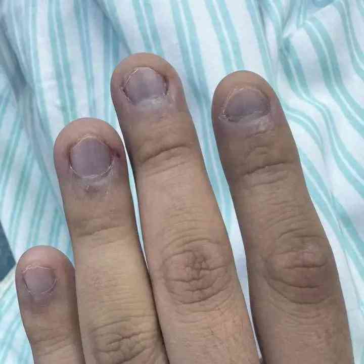 冬季必备咸菜竟暗藏杀机,每年都有人中毒进医院!
