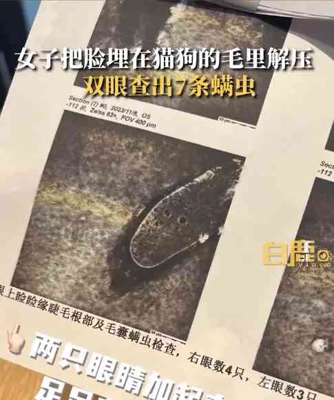 女子抱猫抱狗解压,想不到结果竟是7条螨虫!