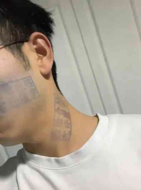 "年轻小伙脸上竟附着顽固印章,求助网络引关注"