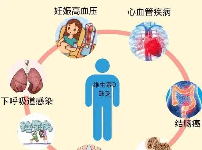  冬日阳光下的健康秘密揭晓！你缺乏这种“阳光维生素”吗？ 