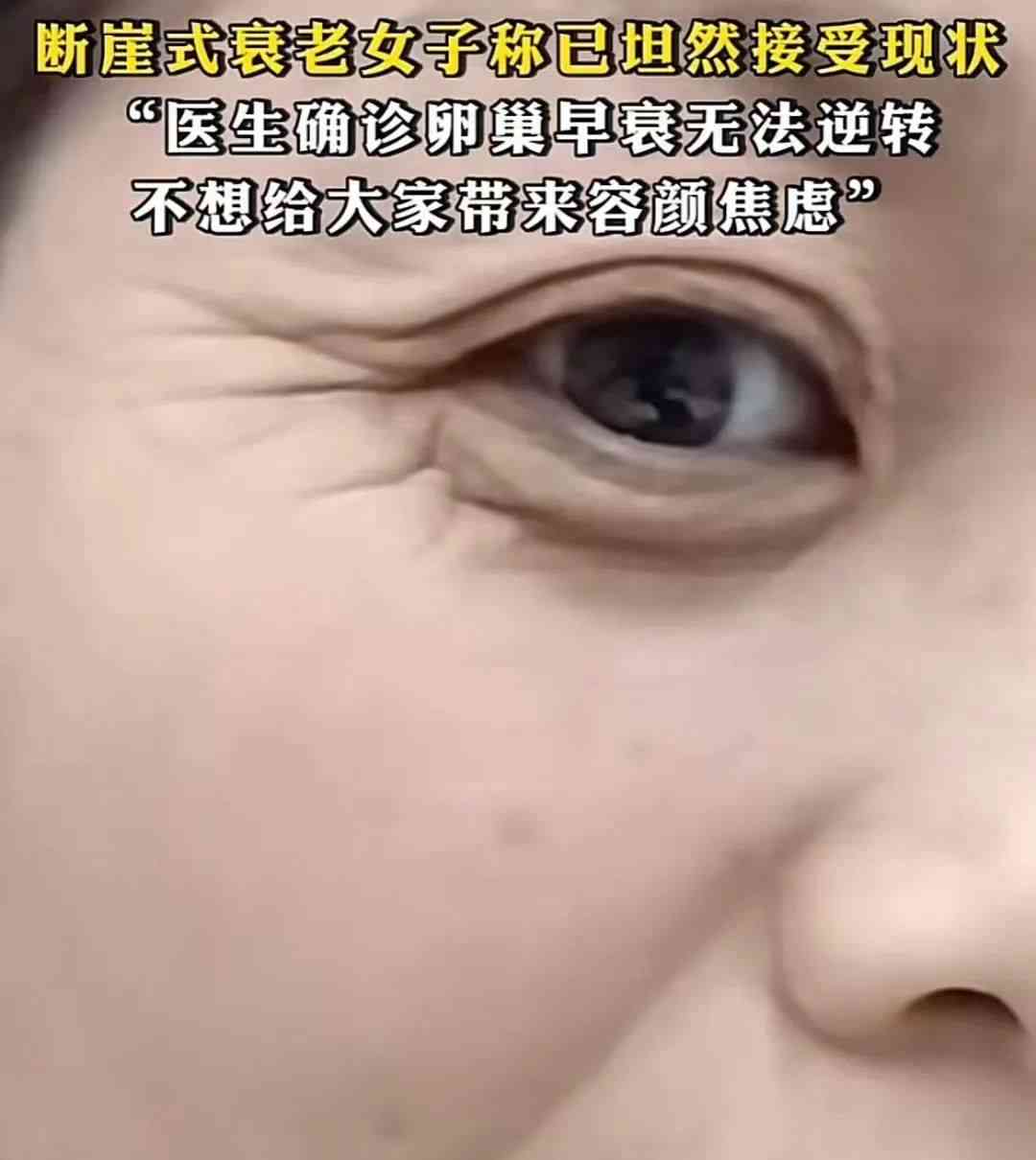  争议视频引发惊慌 卵巢早衰是否令年轻人担忧？ 