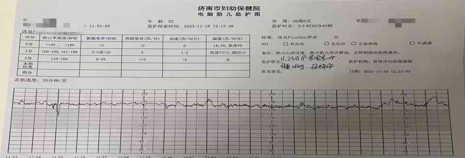 济南率先推出互联网居家胎心监护,孕妇享受智慧健康服务