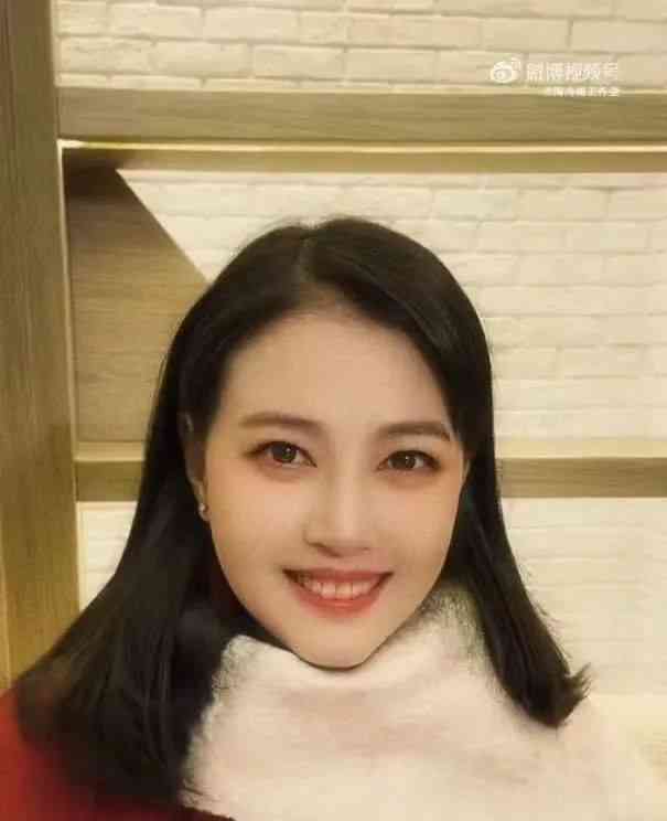 红斑狼疮成女性健康隐患,周海媚逝世引发讨论