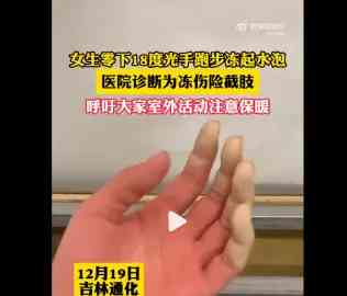 女孩零下18度光手跑步险截肢,引起关注和讨论