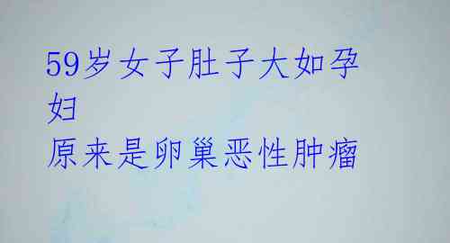 59岁女子肚子大如孕妇 原来是卵巢恶性肿瘤